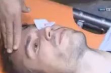Ван Перси порвали веко в матче чемпионата Турции ВИДЕО