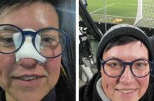 Ronaldu tufayli burni singan muxlisa futbolchidan sovg'a oldi