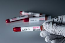 APLda yana ikki nafar insonda koronavirus aniqlandi
